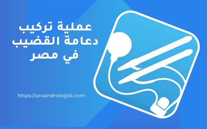 عملية تركيب دعامة القضيب في مصر 2022 بافضل تكلفة